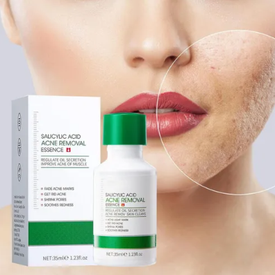Sérum De Acido Salicílico 35ml - Imagen 2